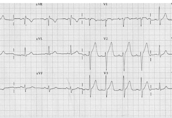 Project Description Image
